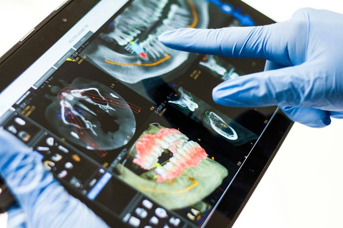A dental professional pointing at a 3D scan of teeth on a tablet